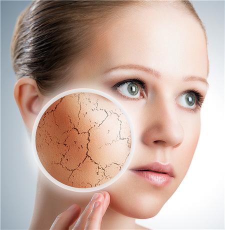 夏天脸上干燥起皮怎么办,夏天脸上干燥起皮用什么护肤品