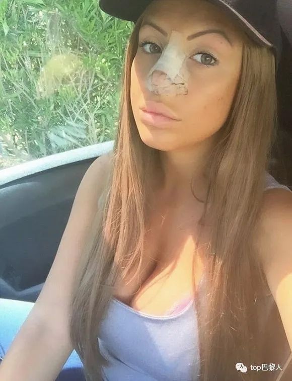 法国情侣豪掷200万,经历15次手术,只为成芭比与肯尼