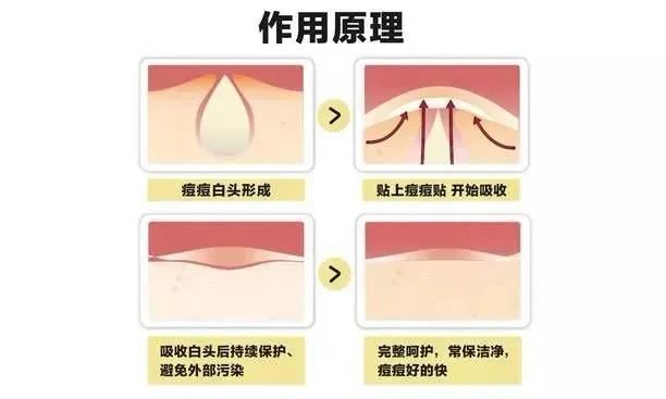 换季脸上爆痘用什么都过敏,换季过敏长痘用什么护肤品