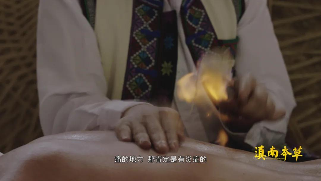 人有些啥病,民间神奇彝医真实故事