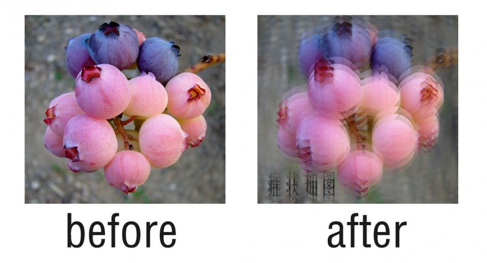 近视散光和单纯散光的症状区别,散光和近视的表现有什么区别