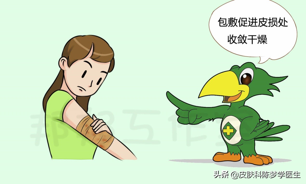 不同分期的湿疹怎么治疗,湿疹痒痒的有什么办法治好吗