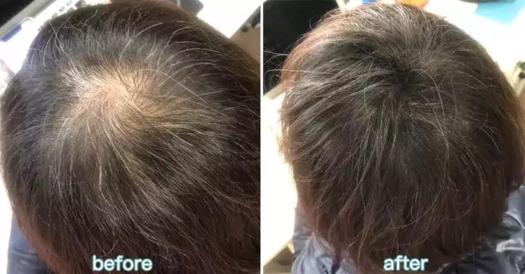 金晨和张歆艺熟吗,金晨晒多张合影为张歆艺庆生