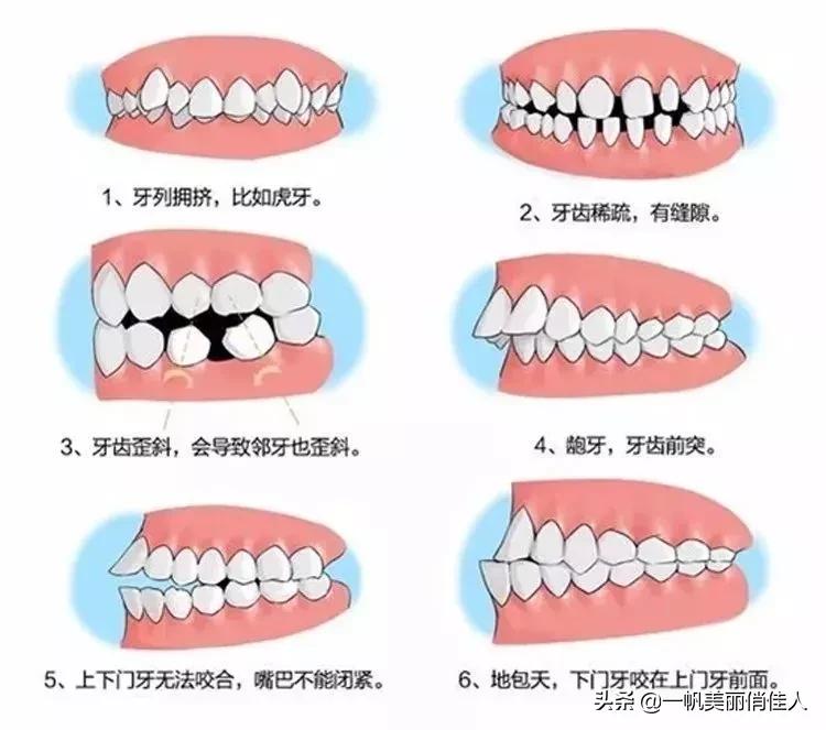 孩子越长越丑的真实原因,7岁以上孩子发展阶段