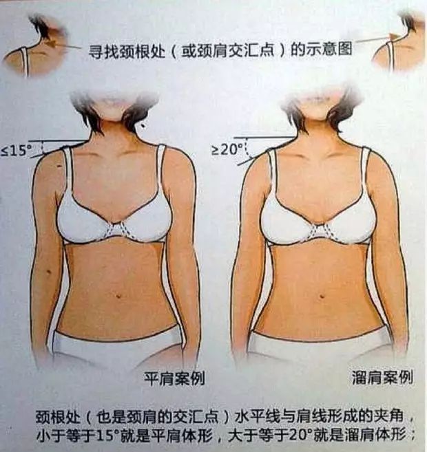 溜肩，长得再瘦体型也垮垮的。但溜肩常见这两种情况，别练错