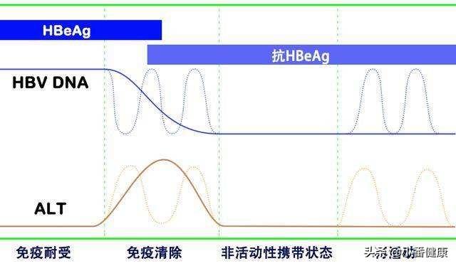 乙肝大三阳治疗方案,乙肝大三阳如何抗病毒治疗