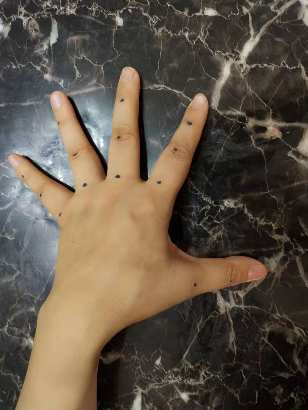 宝宝深夜发烧39度宝妈只用三招,宝宝高烧3天了都没有退怎么办呀