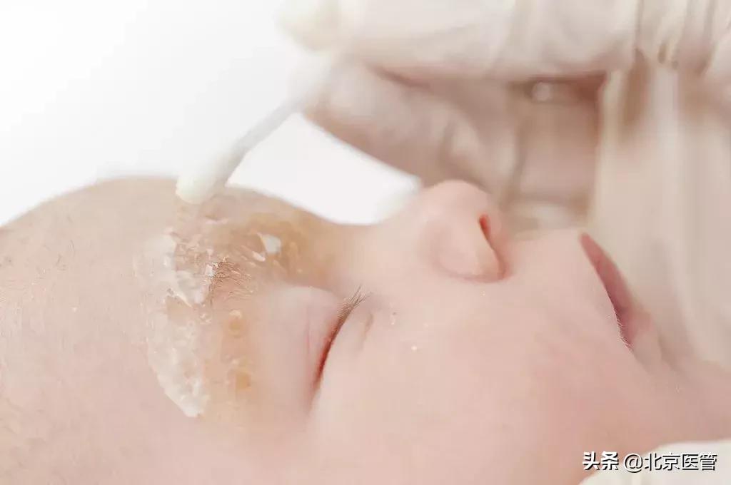 宝宝湿疹用激素药膏有副作用吗,宝宝湿疹用有激素的药膏会怎么样