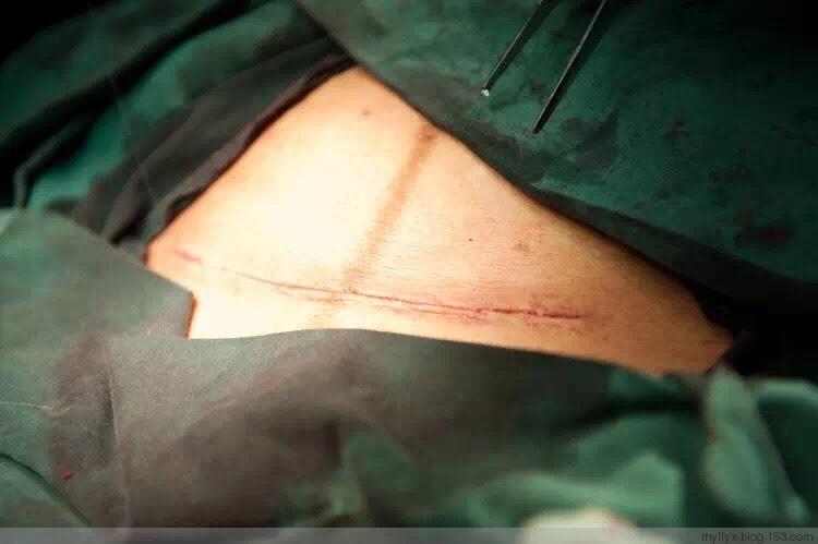 孕期那些事。终极闯关我要生孩子了！啊啊啊