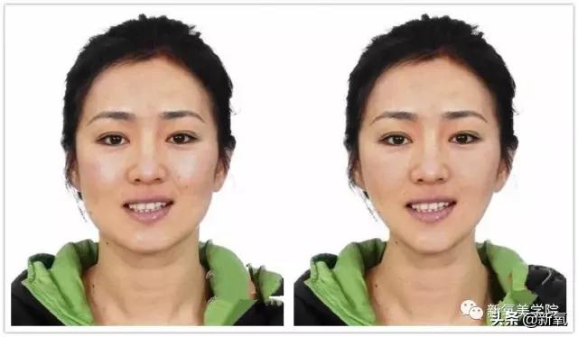 想加宽眉眼间距怎么修复,眉眼间距如何加宽