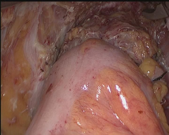 娓崡甯傜浜屽尰闄㈣偪鐦よ兏澶栫,鑲跨槫鍖婚櫌鑳镐簩澶栫