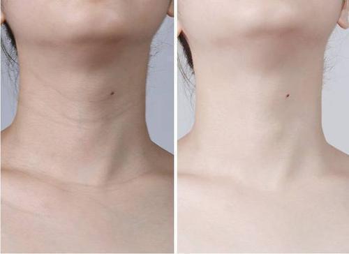 护肤是成套好还是混搭,护肤品成套使用好还是混搭效果好