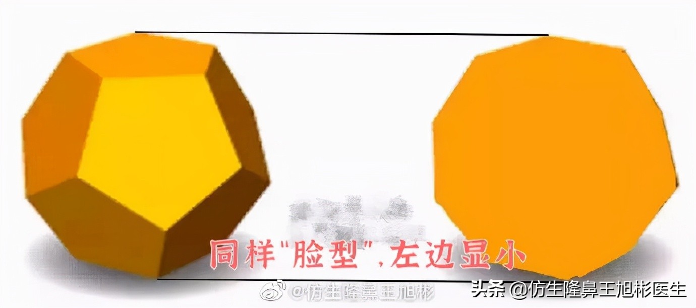 鼻整形后鼻头大,鼻整形后脸小了