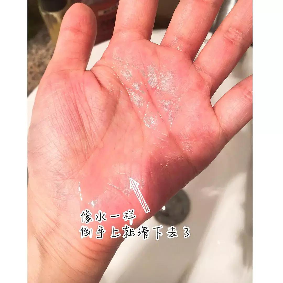 黑头可以用什么方法彻底清除,消除黑头简单有效的方法