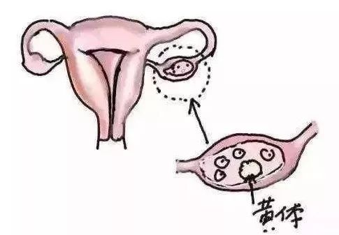 现在疫情可以去医院看妇科吗,疫情期间医院有妇科检查吗