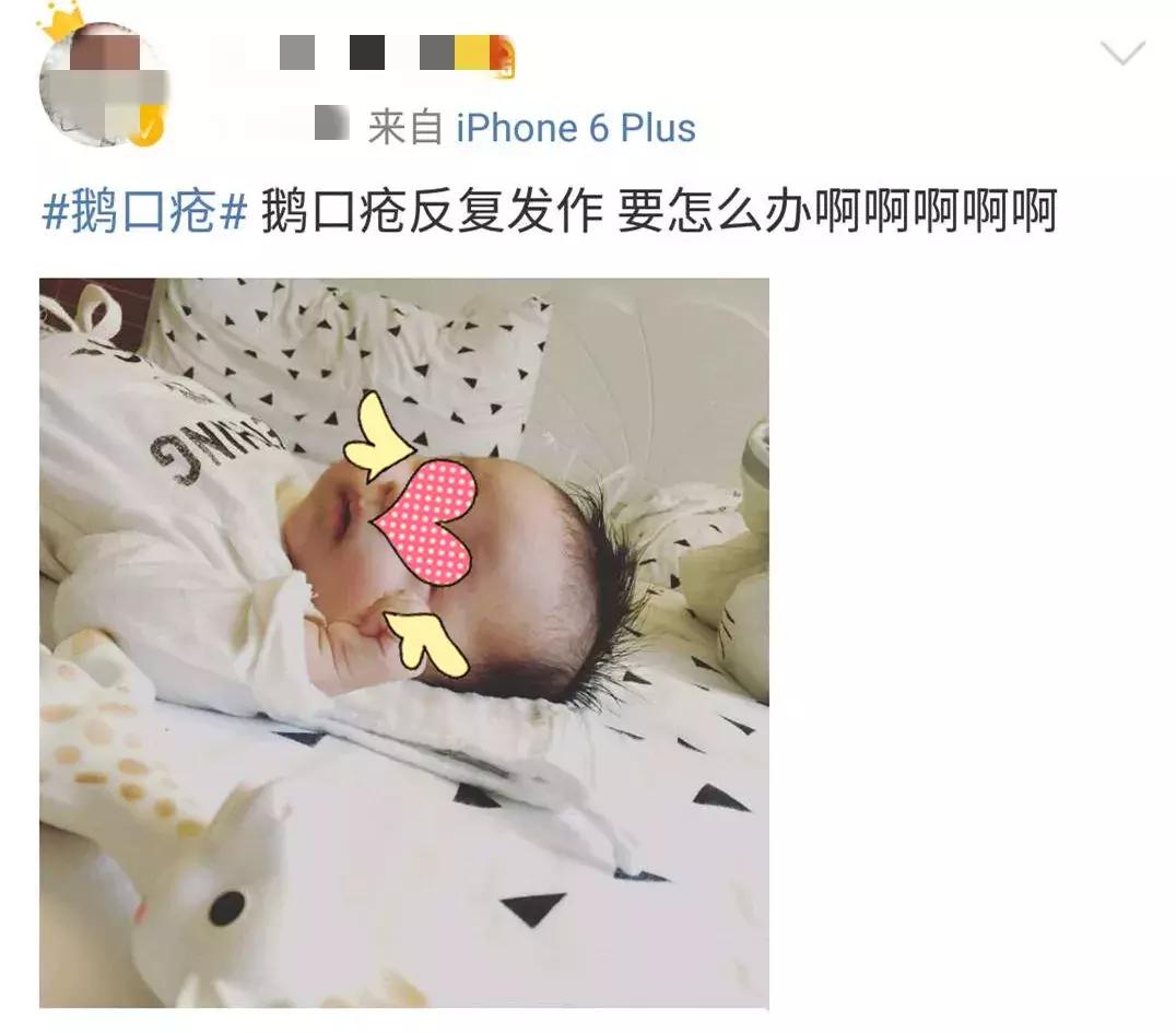 月嫂不懂护理鹅口疮,鹅口疮婴儿月嫂怎么护理