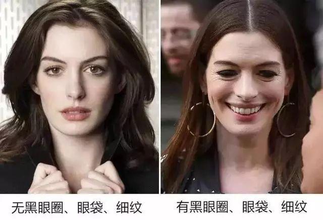 玻尿酸蒸汽热敷眼罩有用吗,热敷眼罩可以加速玻尿酸代谢吗