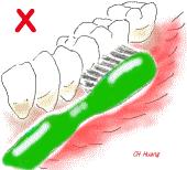 牙齿缺失后不镶牙有啥危害,牙齿缺失后不补有什么危害