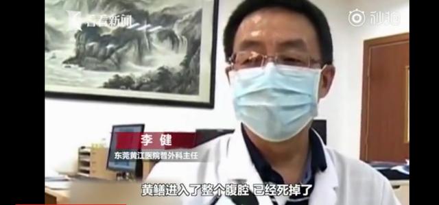 男子偏方治便秘塞入黄鳝险些丧命,男子将黄鳝塞体内治便秘