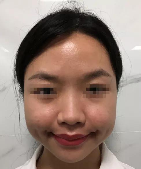 肉方脸如何改善,骨骼型短方脸适合什么发型显温柔