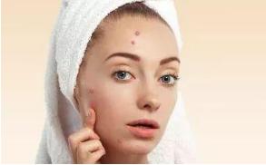 一直长痘痘反反复复怎么调节,总是反反复复长痘痘怎么办