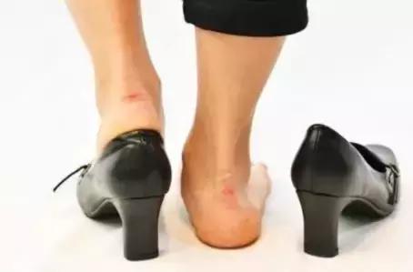 鞋子大小合适但是磨脚后跟小妙招,鞋子买大了磨脚小妙招