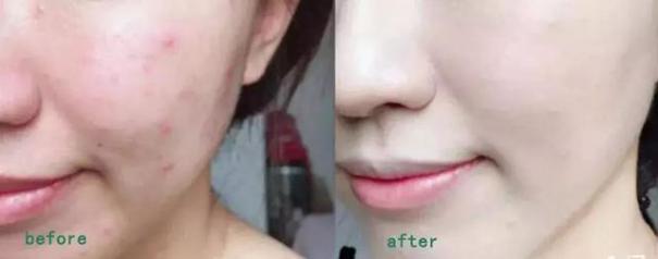 一支bb霜买一送一,一支一支的bb霜