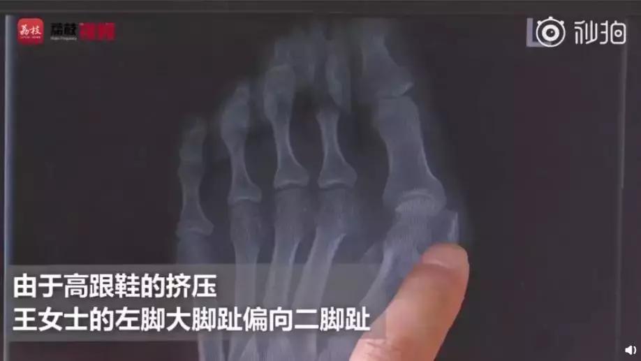 泥土高跟鞋,本色高跟鞋