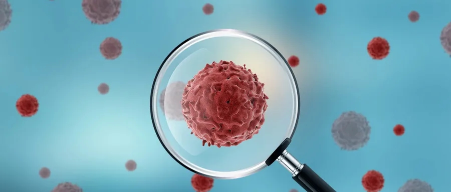 总是怀疑自己得了宫颈癌怎么办,手术阴性怀疑早期浸润宫颈癌