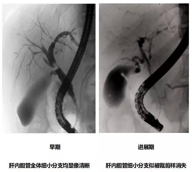 ps所有疑难杂症,ps疑难杂症