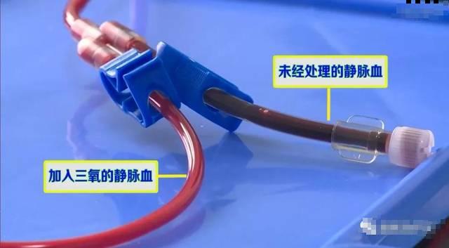 更年期血脂高胆固醇高怎么办,更年期女人高血脂一天的饮食