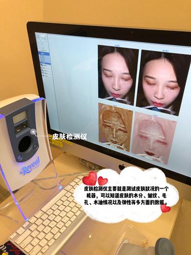 香港pico祛斑怎么样,香港皮秒淡斑