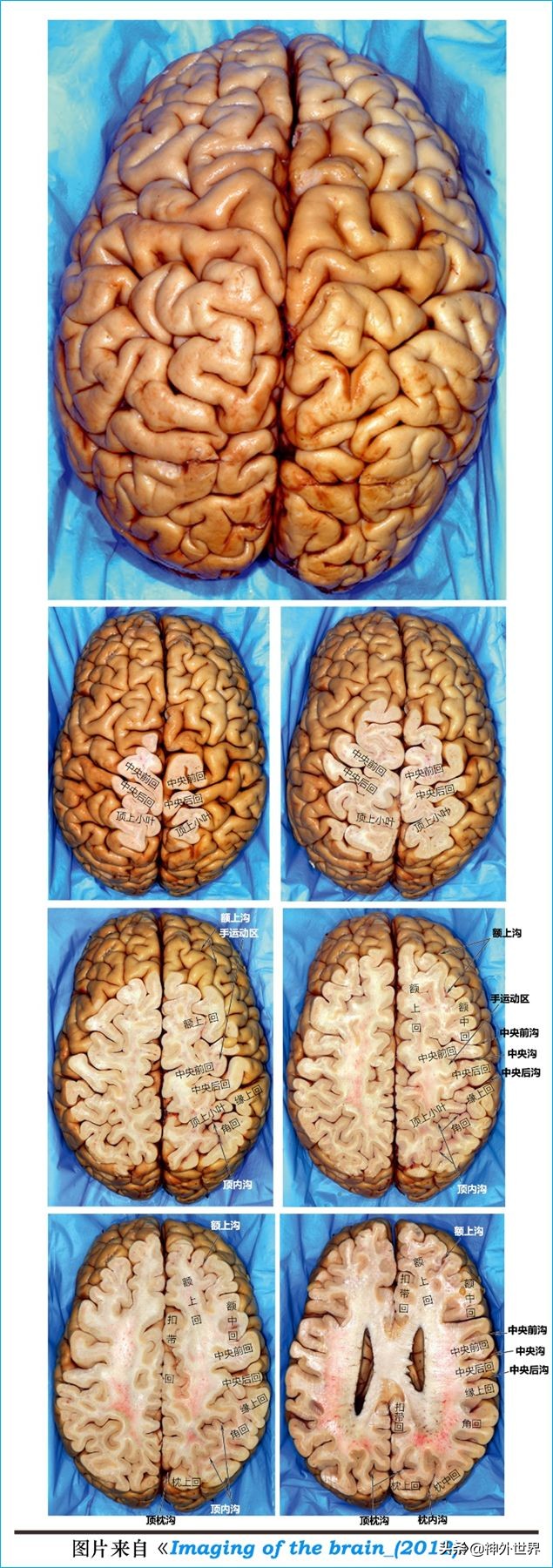 脑解剖学讲解视频全集,脑功能解剖学习