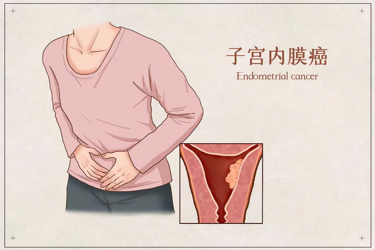 为什么中国女性基本都有妇科炎症,中国女性患妇科病的比例