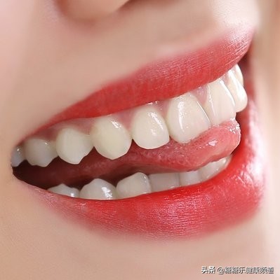 教你如何快速美白牙齿效果显著,大神教你一招美白牙齿