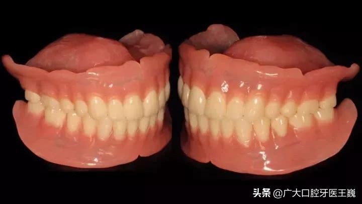 较好的活动义齿能用多久,目前最先进的活动义齿