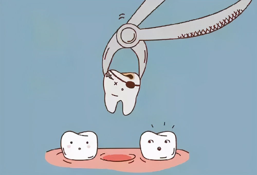 6岁儿童蛀牙牙痛要做根管治疗,蛀牙根管治疗后需要注意什么