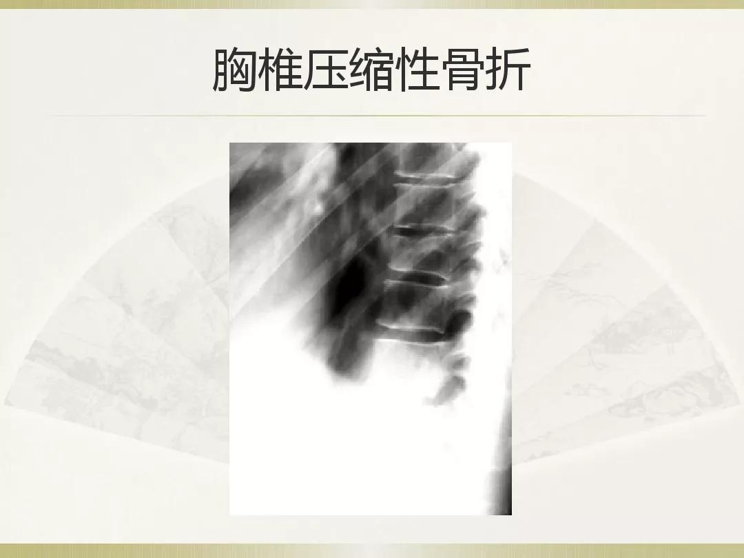 骨科x光片读片技巧,放射科骨科读片教程