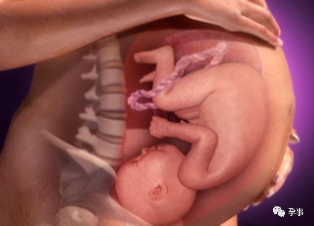 生孩子真有那么痛的体验,咱们女人得知道生孩子到底有多痛