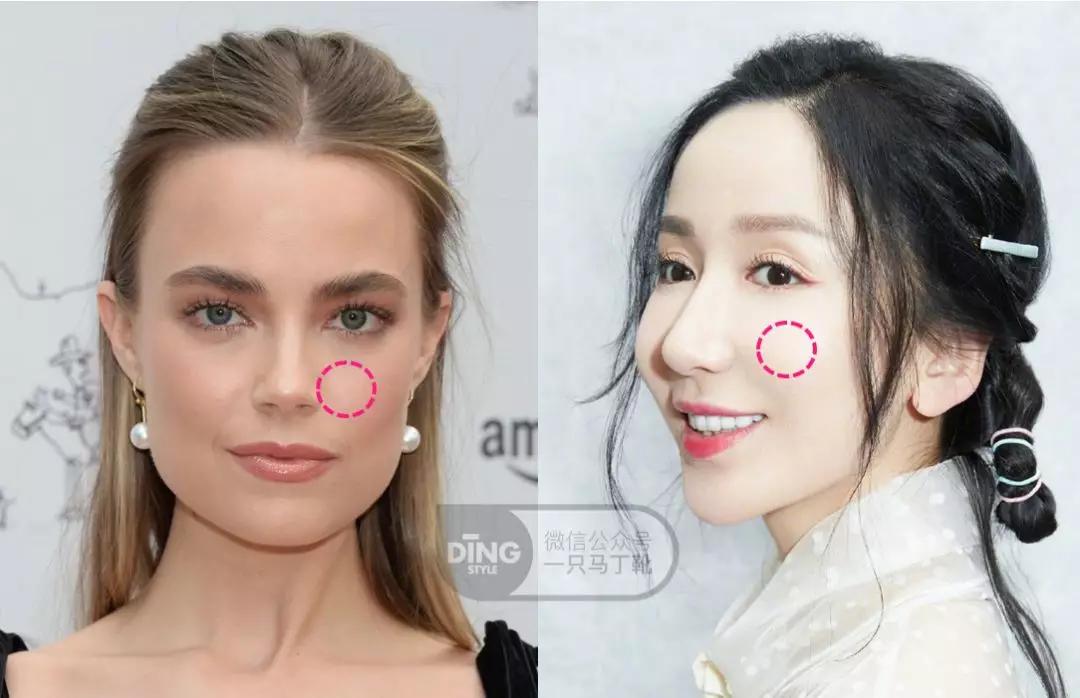 颧弓高脸型怎么改善,有泪沟可以通过调整脸型改善嘛