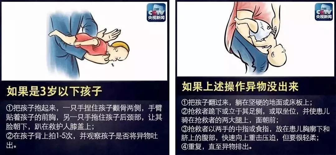儿童气道受损多久能恢复,孩子气道阻塞怎么办