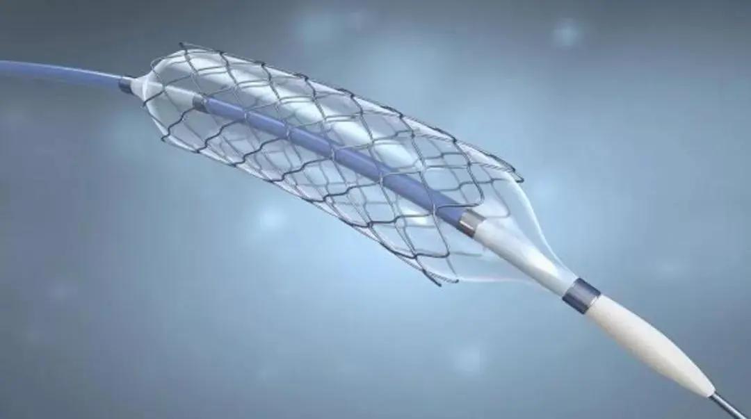 心脏支架价格到底是怎么降下来的,心脏支架昂贵的背后