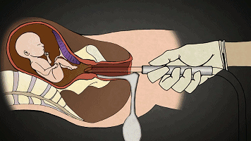 男人爱不爱你看他肯不肯为你花钱,产房可以看出男人爱不爱你