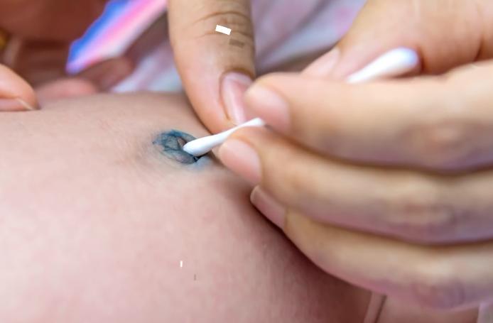 新手婴儿屁股怎么护理,新手父母的宝宝护理技巧