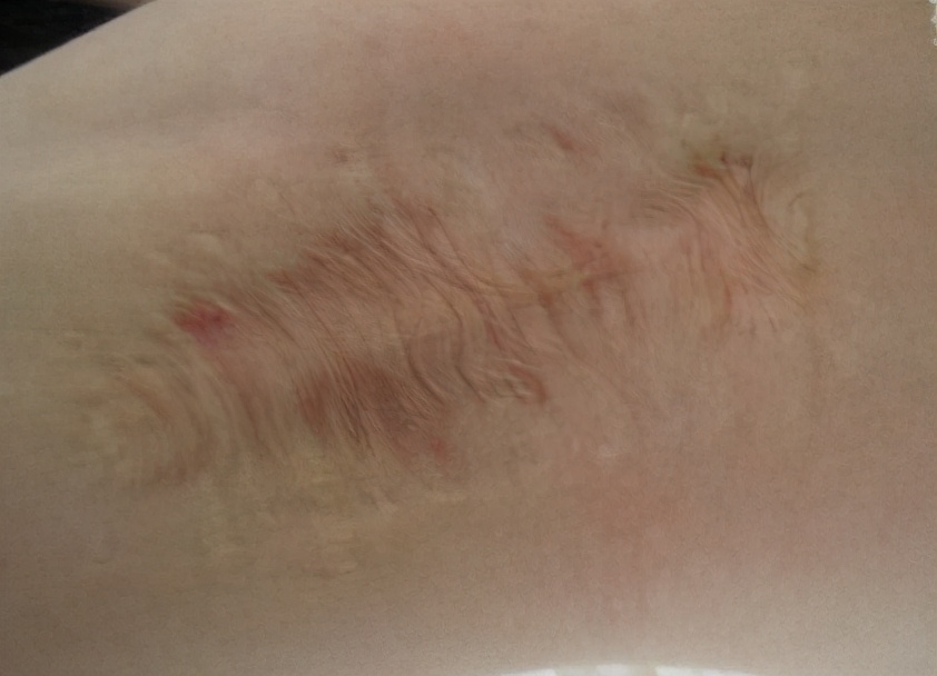 狐臭是怎么产生的?到底是疾病还是生理现象,该怎么根除?