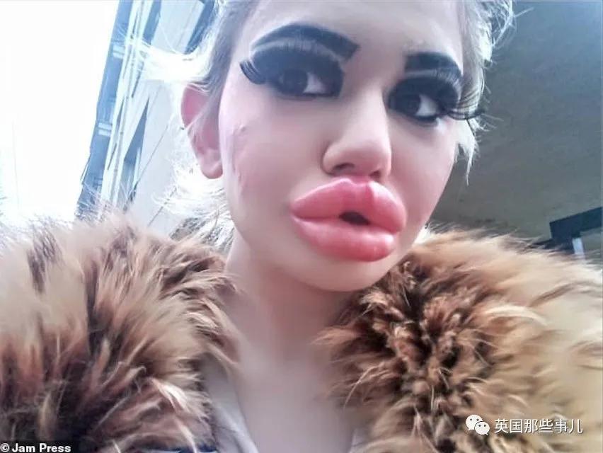 20次整容成功的女人,20次丰唇