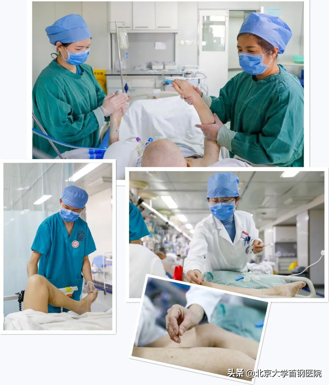 icu获得性肌无力定义,icu获得性肌无力能治愈吗