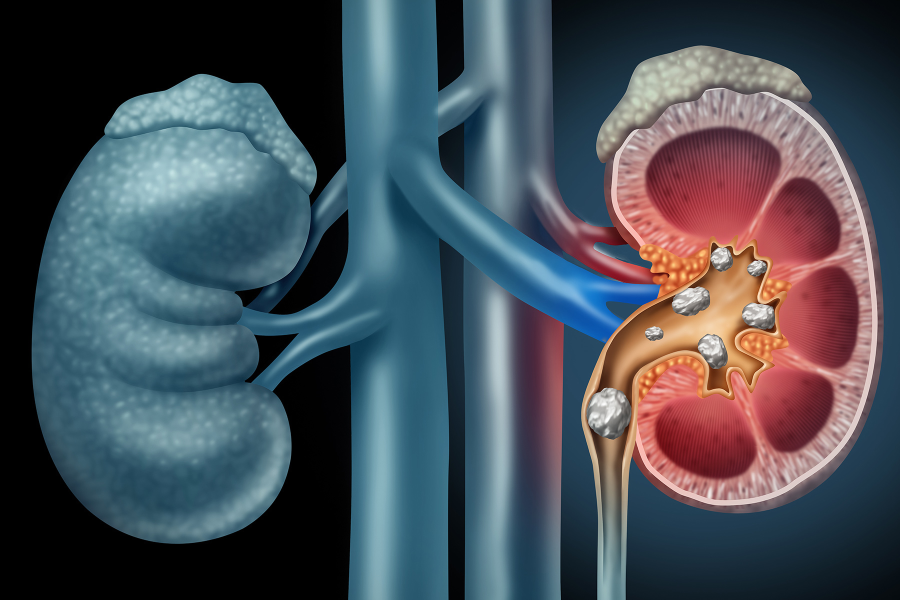 尿频，17种可能