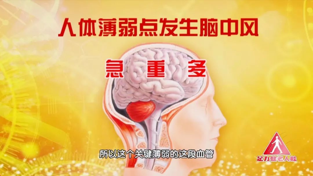 脑血管极细是不是特别危险,脑血管狭窄致命吗