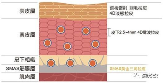 1000片面膜,水光针一次相当于多少片面膜